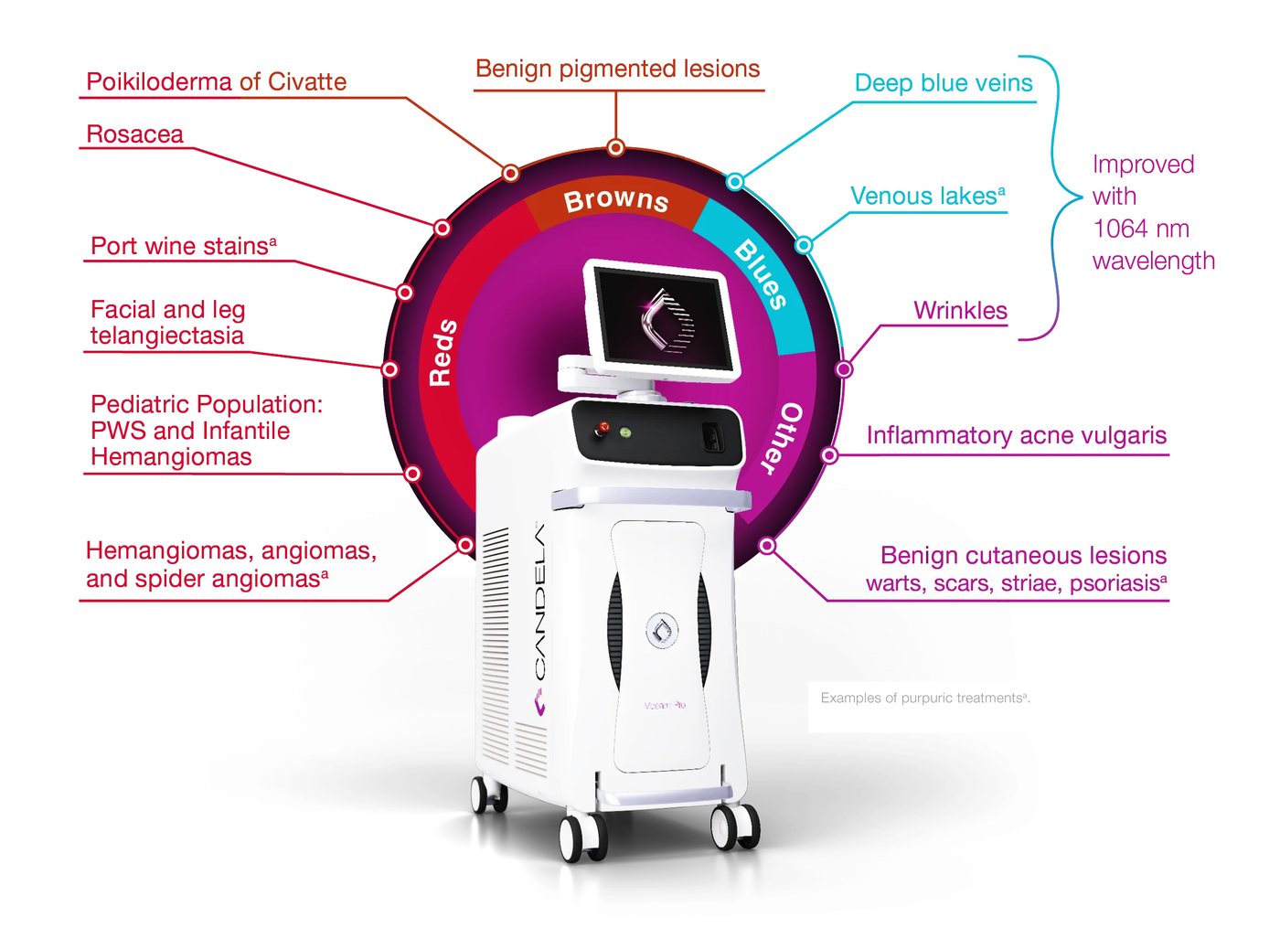 What the Vbeam Pro treats, grouped by the color it targets. Source: Candela Medical.